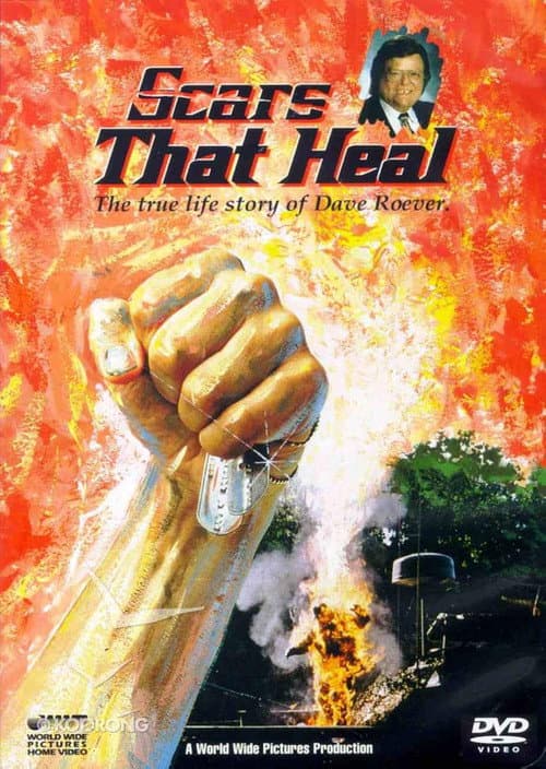 Poster for Scars That Heal: The Dave Roever Story