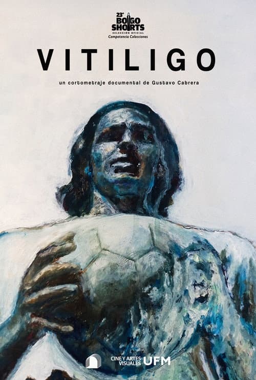 Poster for Vitiligo