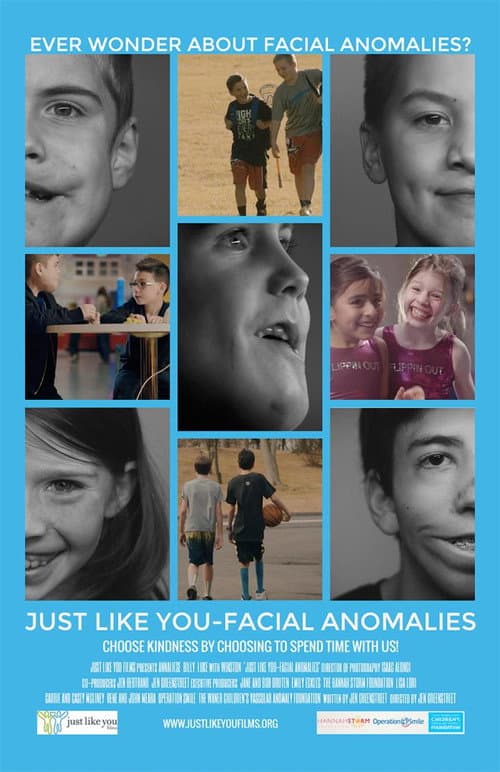 Poster for Just Like You: Facial Anomalies