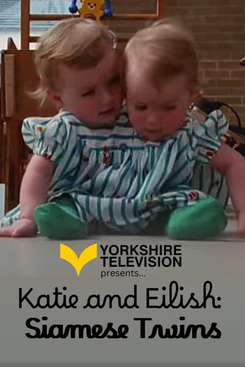 Poster for Katie and Eilish: Siamese Twins