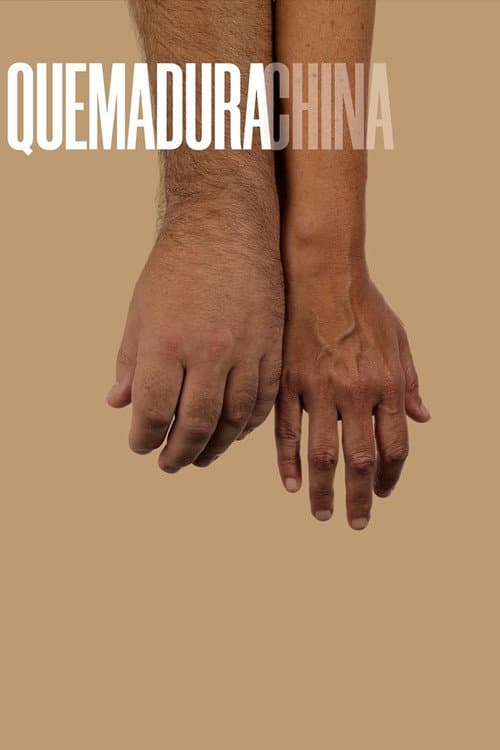 Poster for Quemadura china