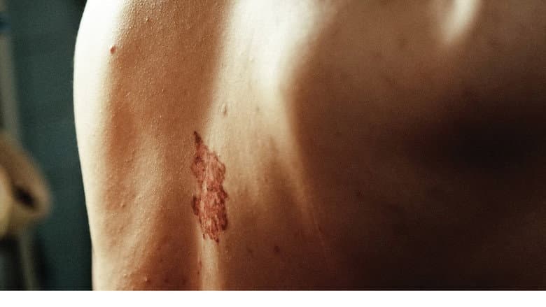 Backdrop from Original Wound