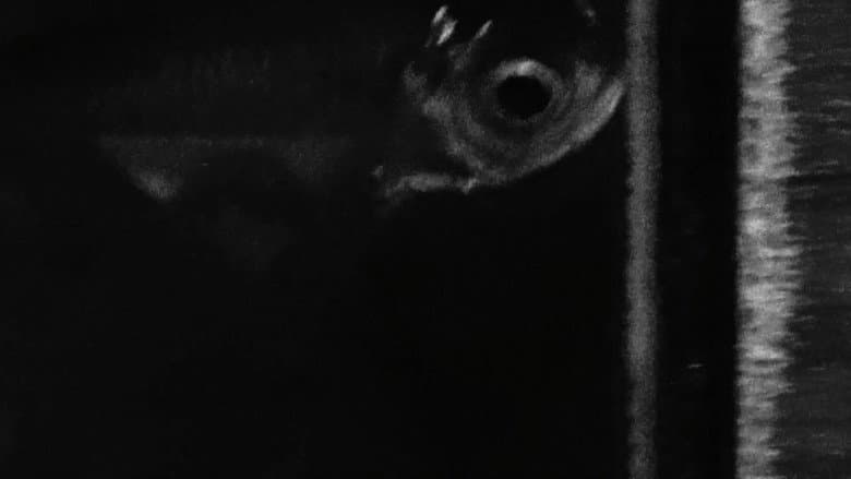Backdrop from Anomalies (Fibrosis)