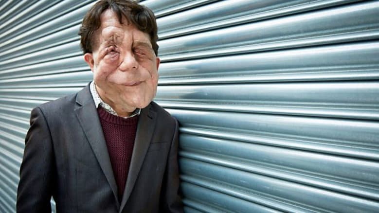 Backdrop from The Ugly Face of Disability Hate Crime