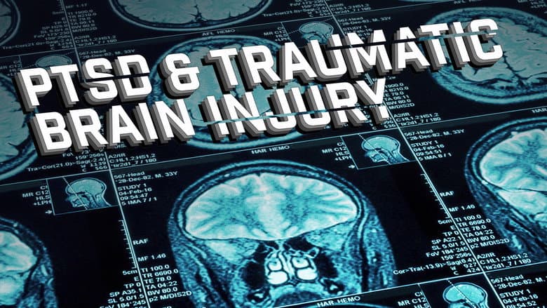 Backdrop from Joel Hunt: Traumatic Brain Injury (TBI)