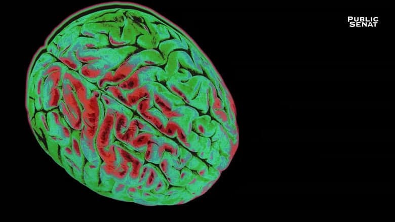 Backdrop from Le pouvoir nuit-il gravement au cerveau ?