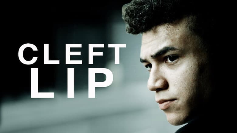 Backdrop from Cleft Lip