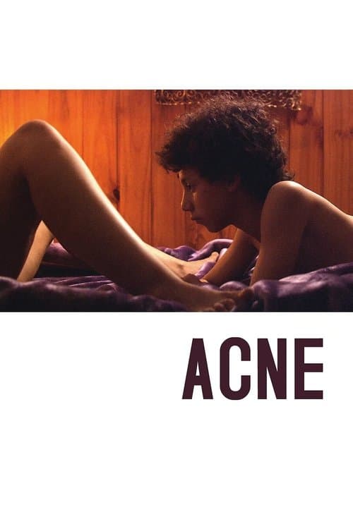 Poster for Acne